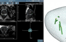 SNUа,    MRI  ǥ ˻ 